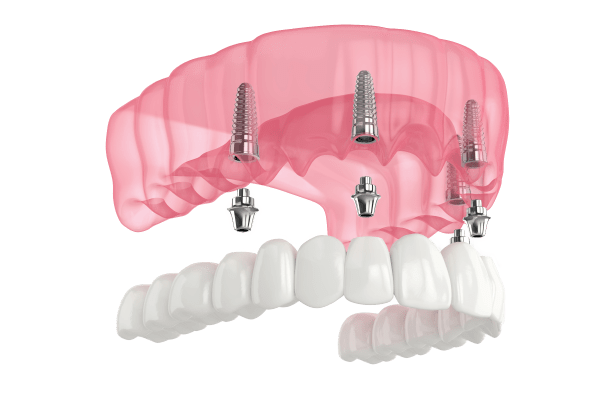 Description of image at Frank Dunlap, DDS in City, State