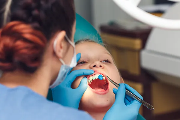 Young boy patiently keeping his mouth open while his dental assistant applies fluoride solution to his teeth.