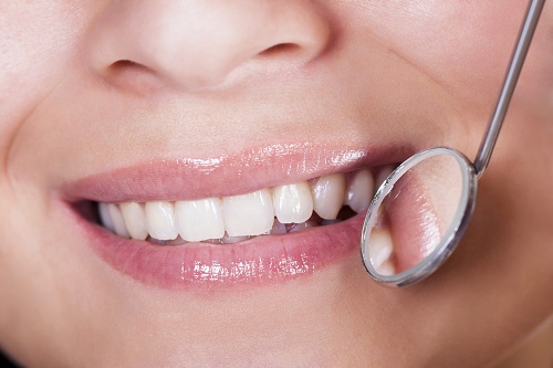 Close up of smiling mouth with dental mirror.