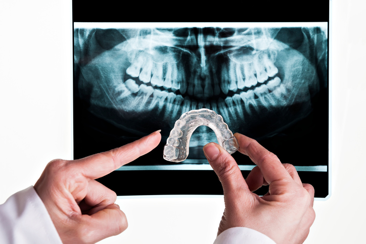 Doctor holding and pointing at mouthguard in front of an x-ray.